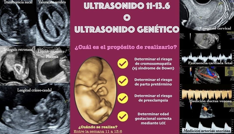 Mireya Ovando Tapia-8