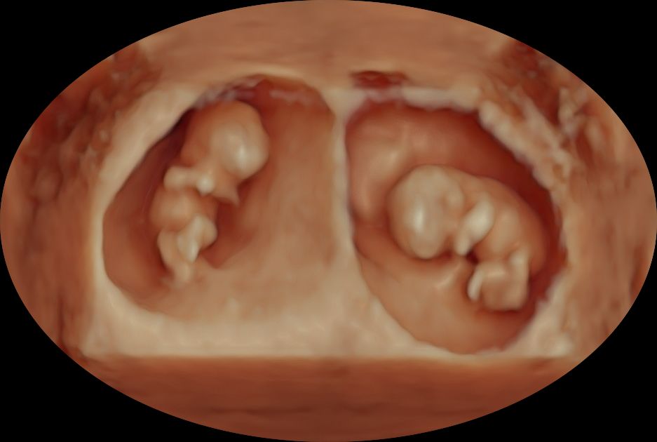 Gustavo Gómez Sánchez-5