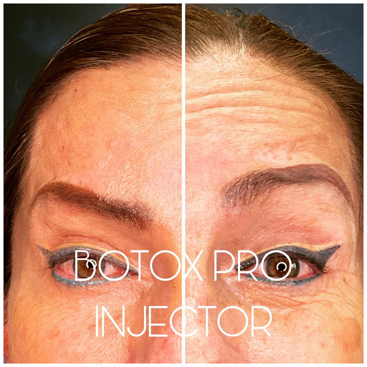 Carlos Alberto Ruiz Zepeda-36