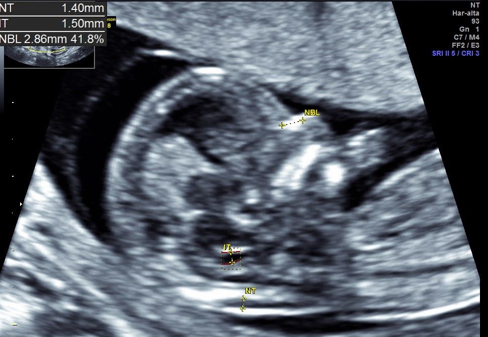 Juan Manuel Enciso Meraz-9