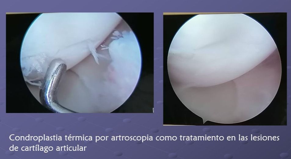 Rubén Rodriguez Acosta-6