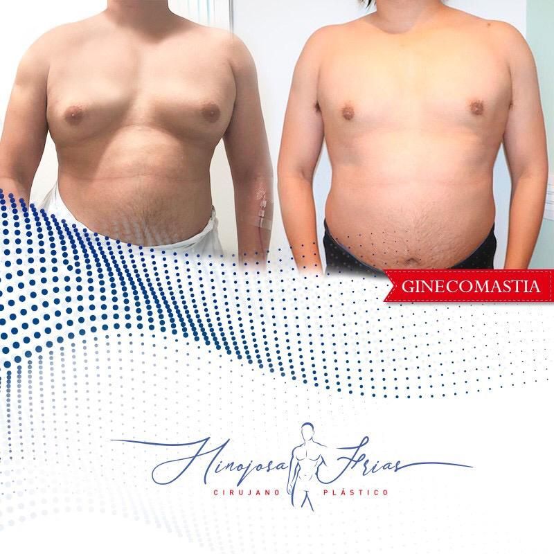 Miguel Ángel Hinojosa Frías-16