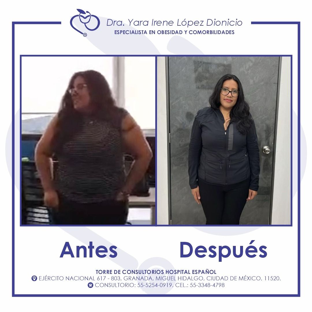 Yara Irene López Dionicio-2