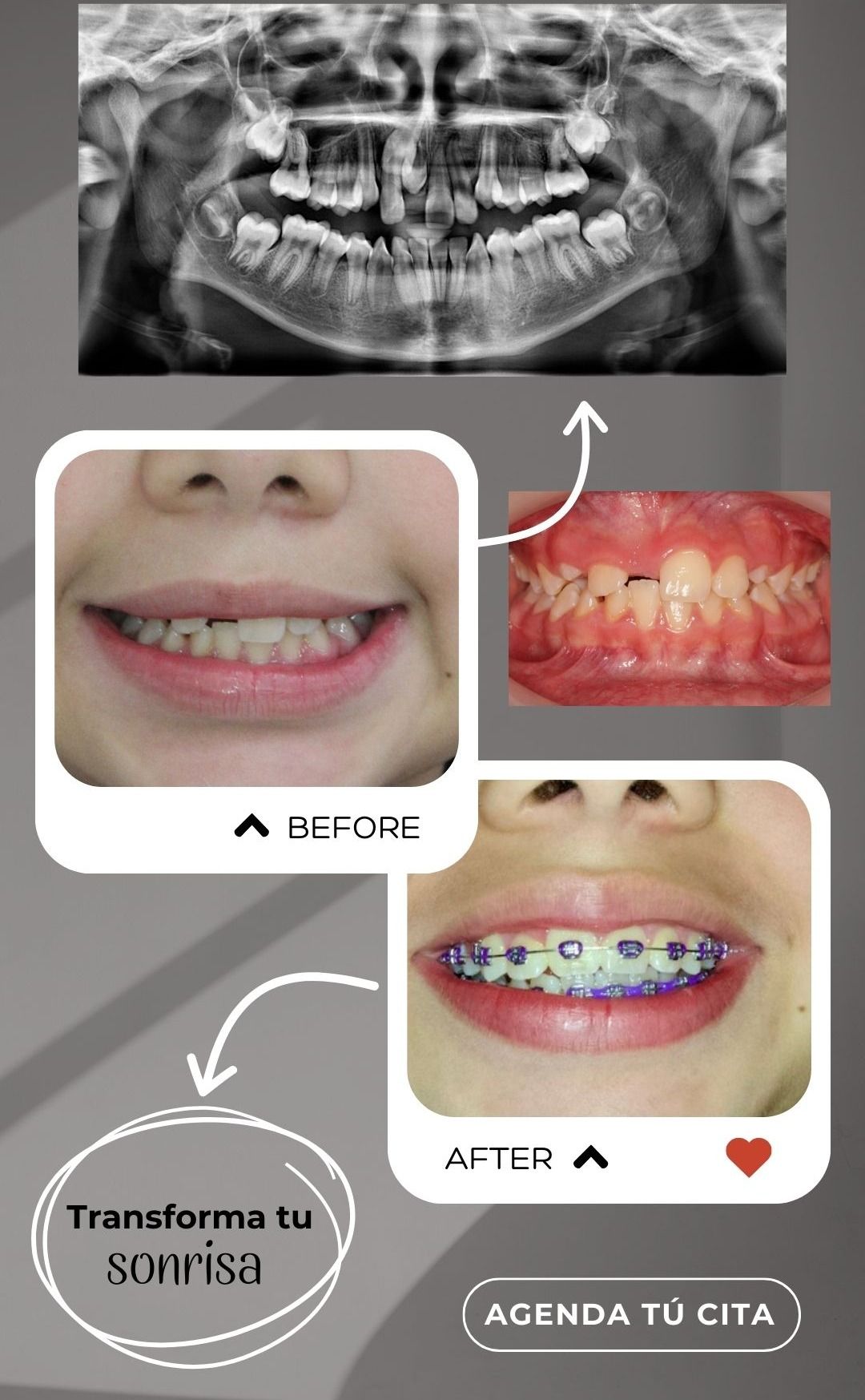 Elizabeth Valenzuela Rivera-4