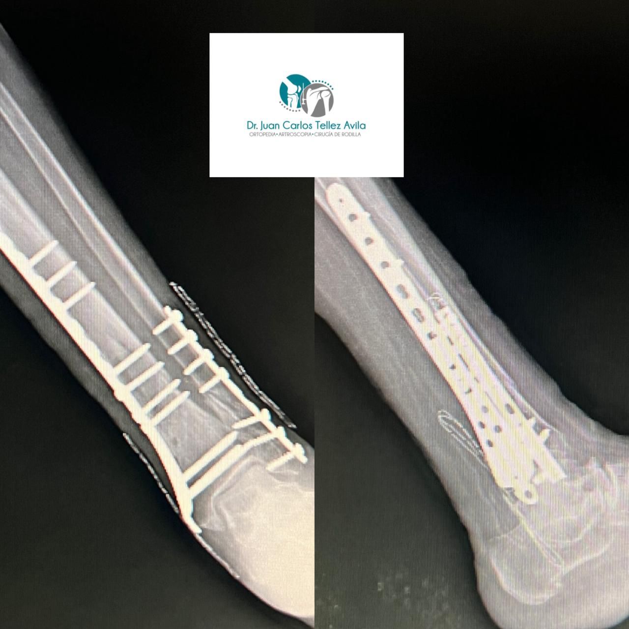 Juan Carlos Tellez Avila-16