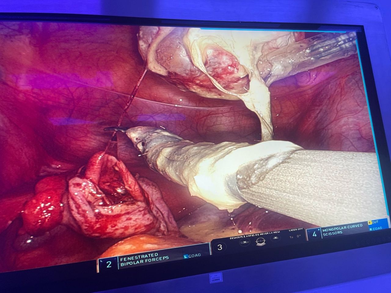 Gonzalo Esteban Pol Kippes-5