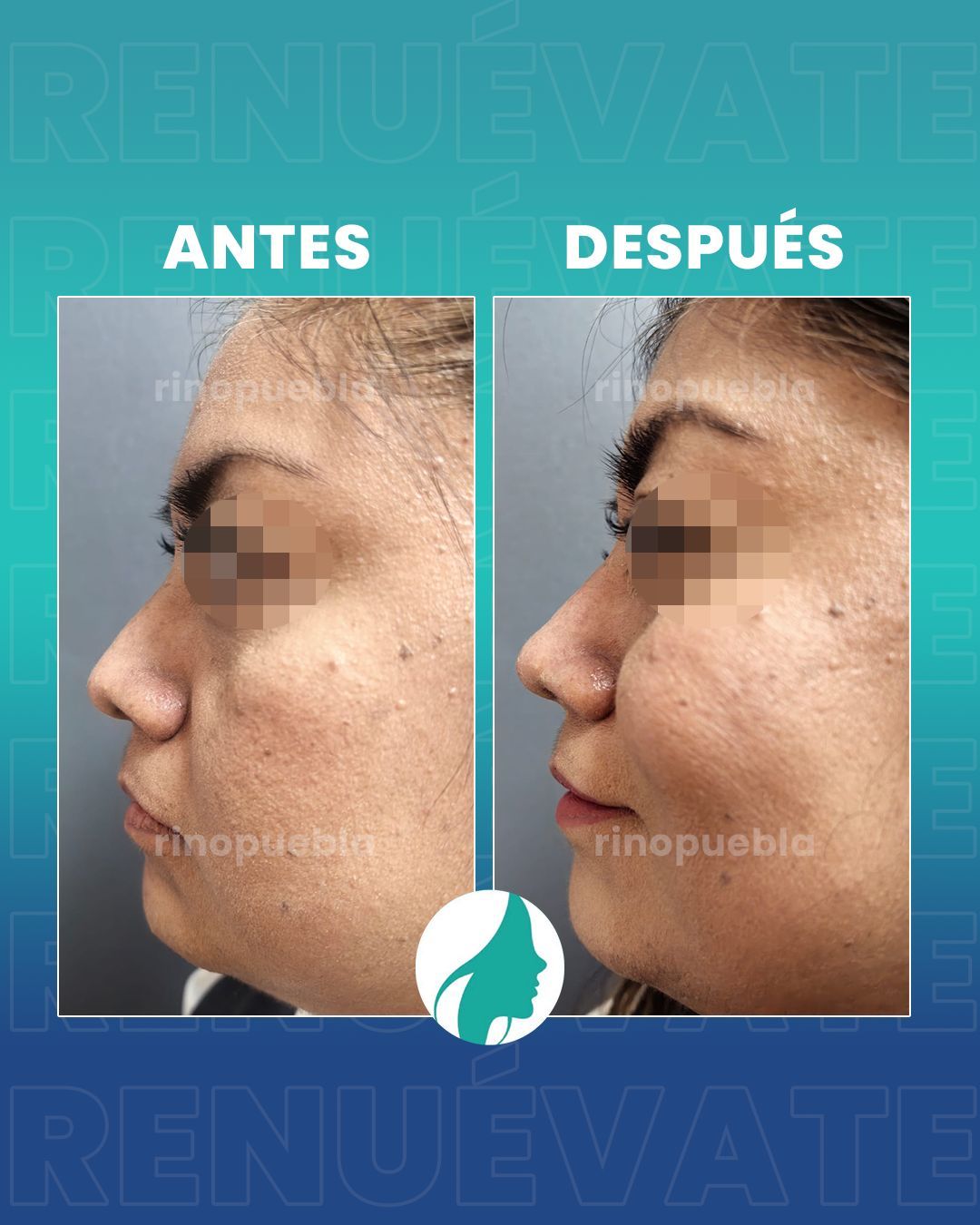 Christian Santander Becerra-11