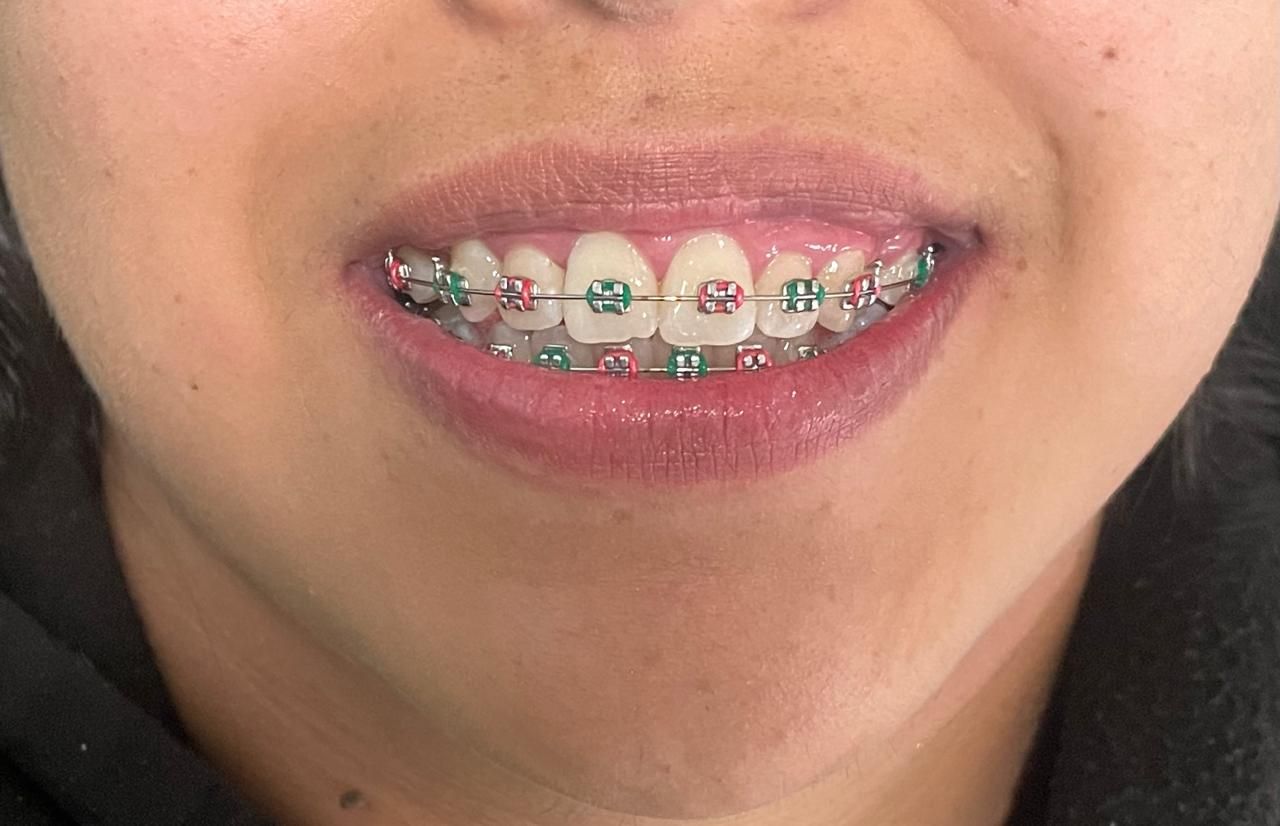 Anuar Becerril Castro-11