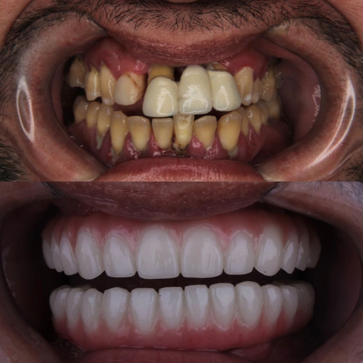 Arturo Mendez Valencia-18