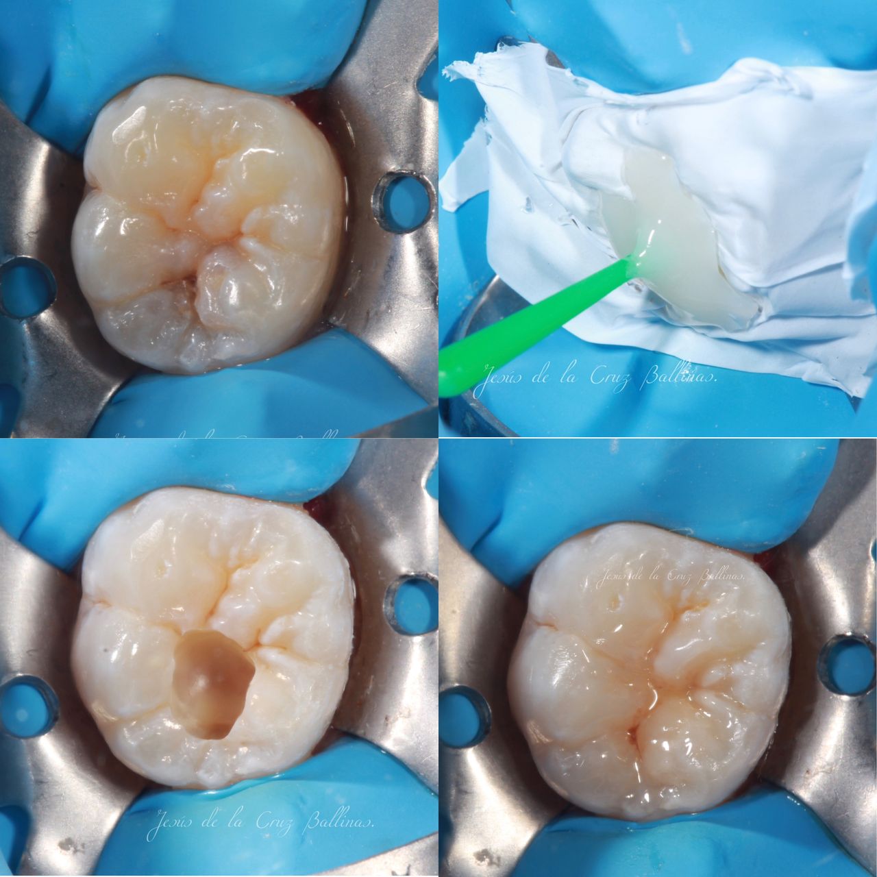 Jesus De La Cruz Ballinas-8