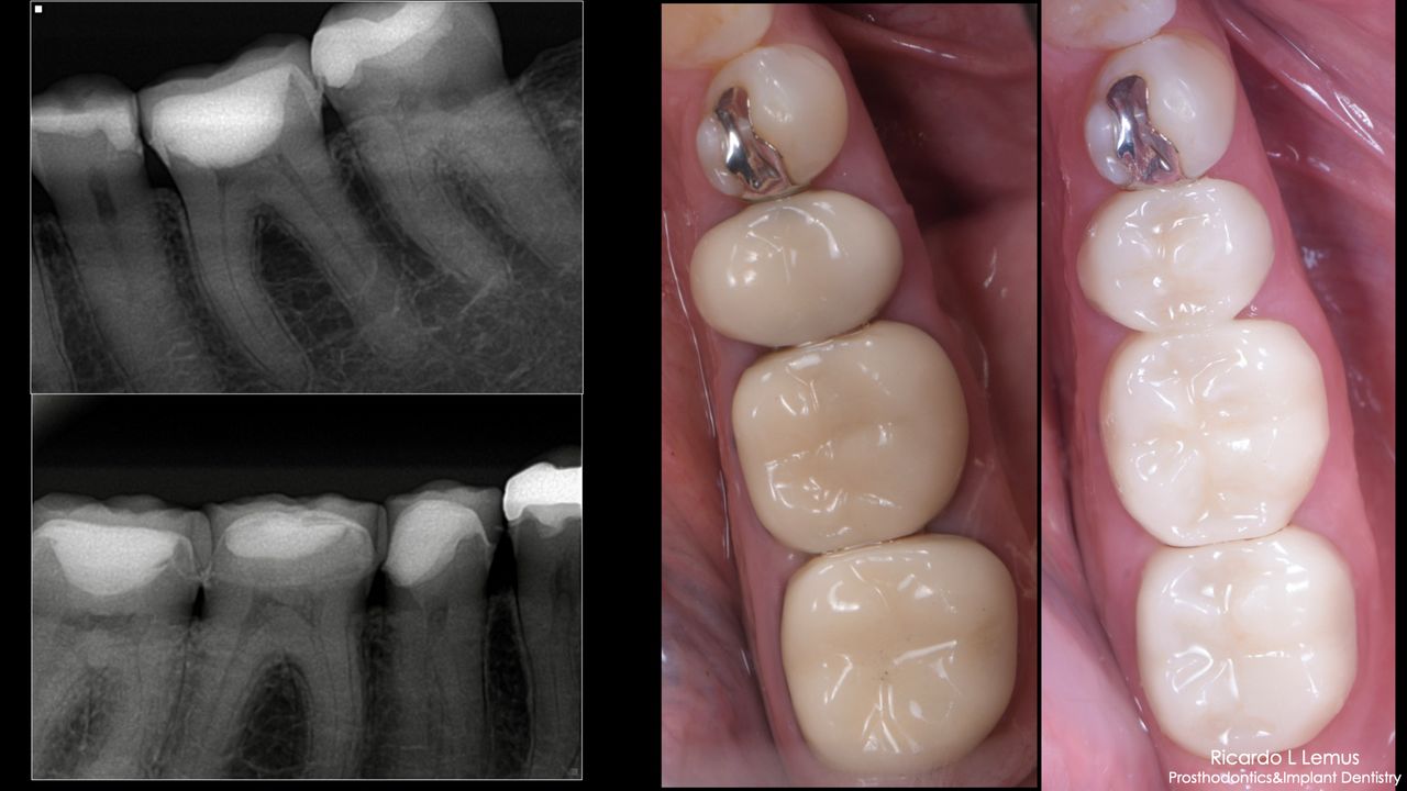 Ricardo López Lemus-117