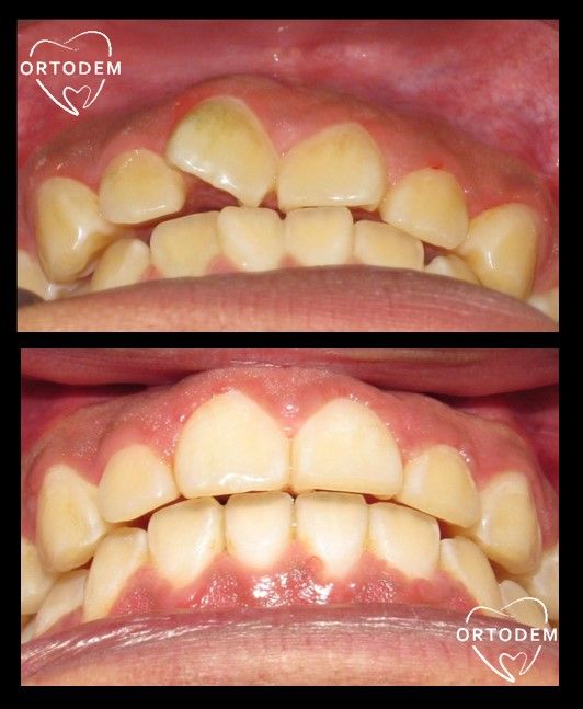 Elizabeth Morelos Morales-18