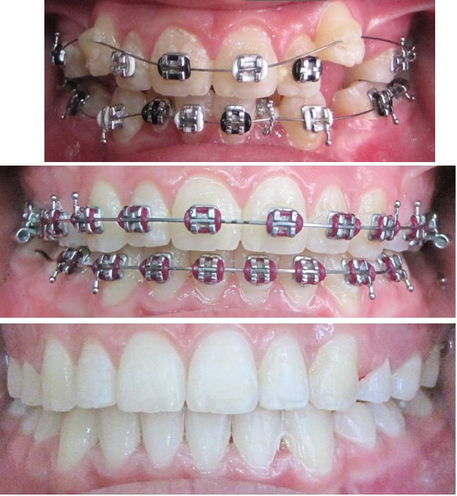 Ma. Elisa Duron Urtado-2