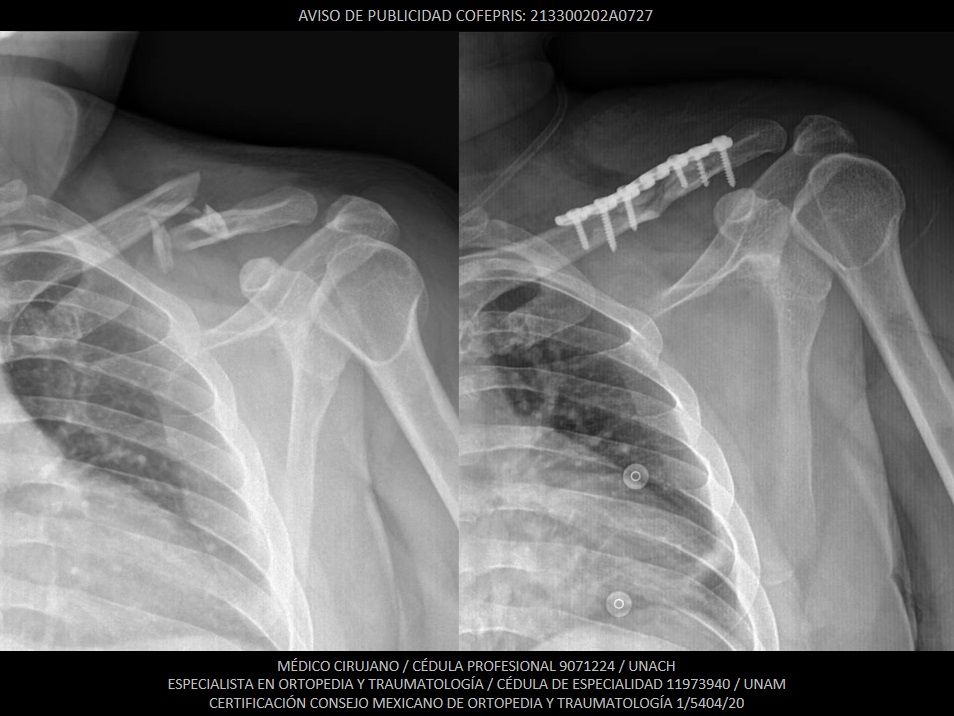 Luis Castañón Robles-17