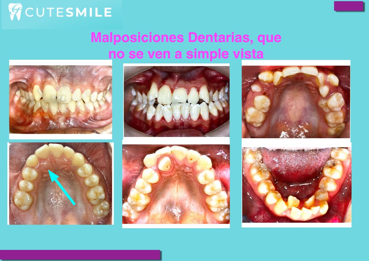 Georgina Zurita Rdz-4