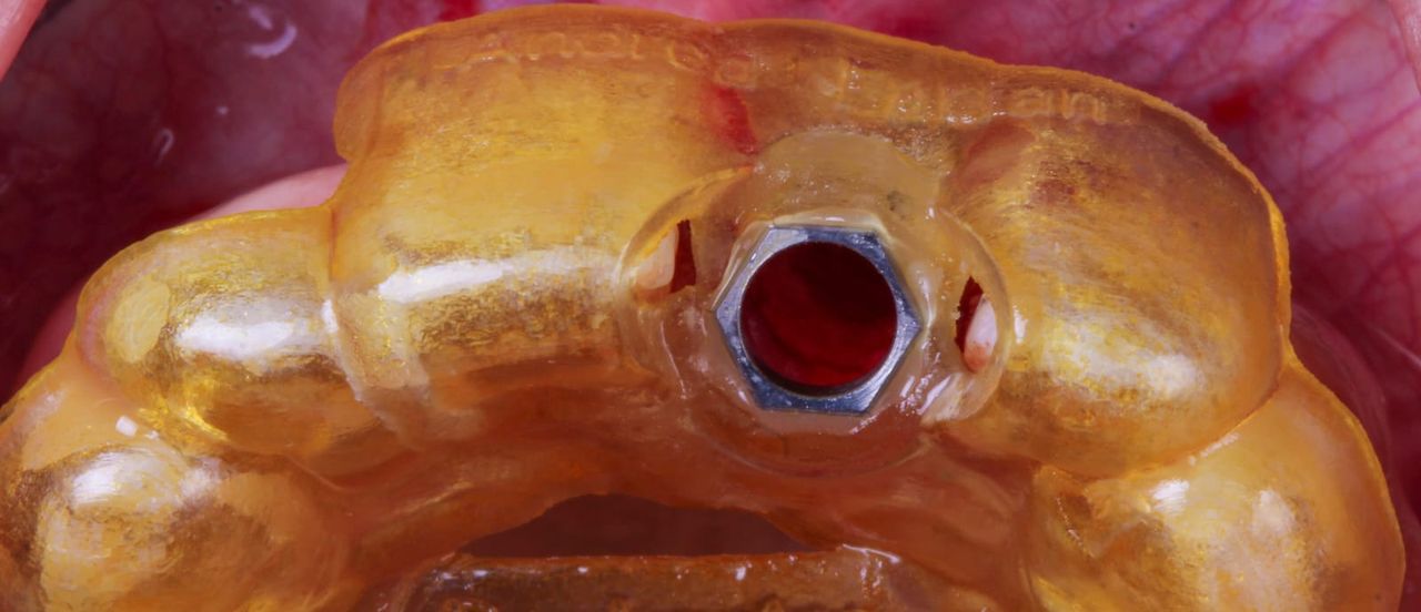 Hugo Enrique Aguilar Lamas-14