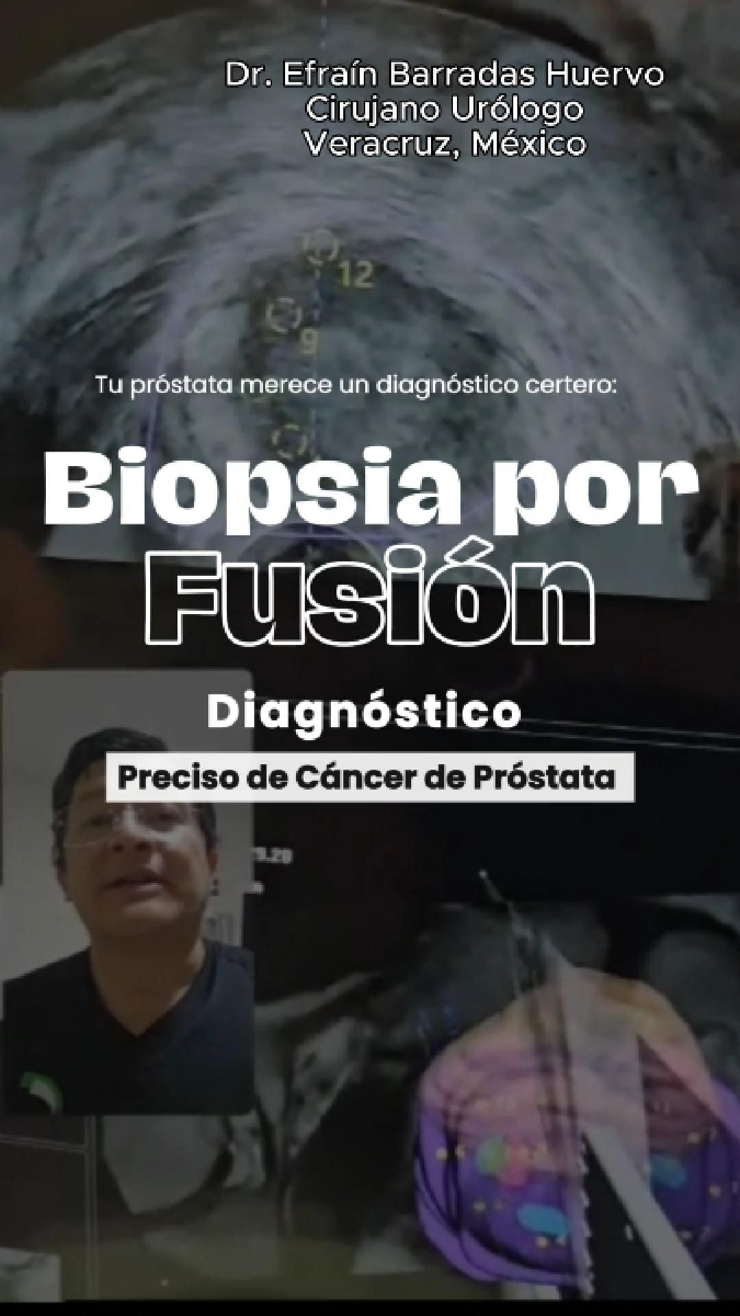 Efrain Barradas Huervo-0