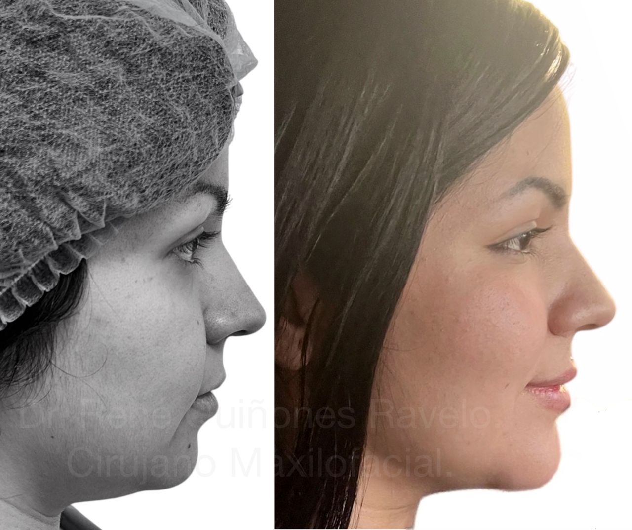 René Quiñones  Ravelo-1