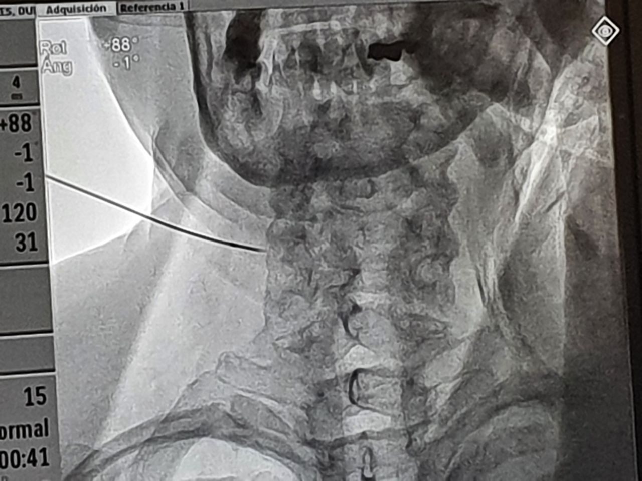 Gerardo Solís Valadéz-1