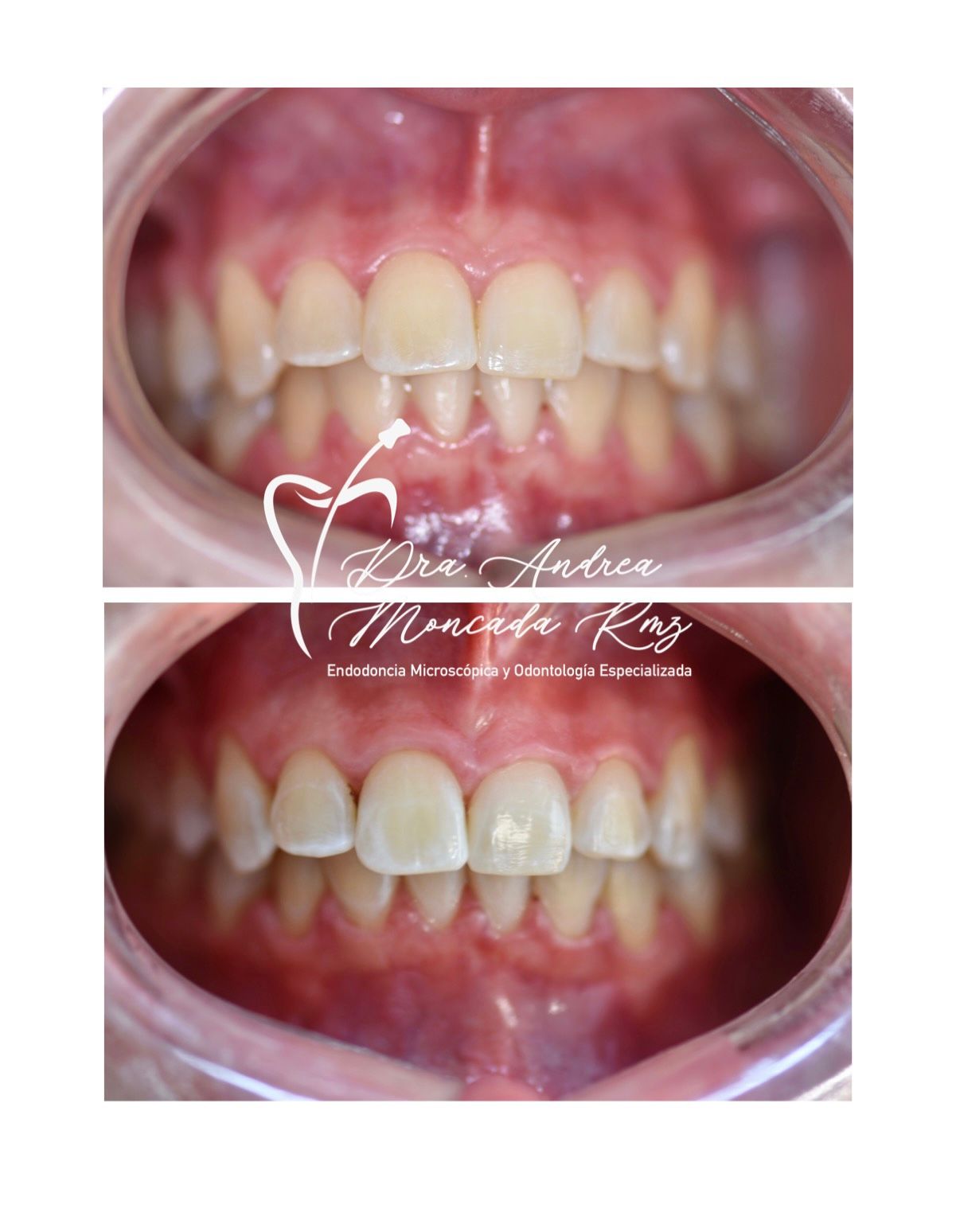 Andrea Moncada Rmz-10