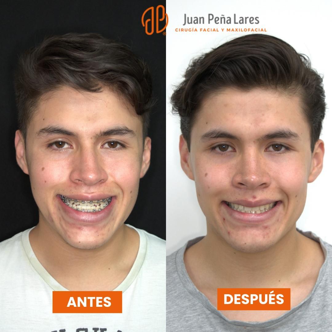 Juan Peña Lares-13
