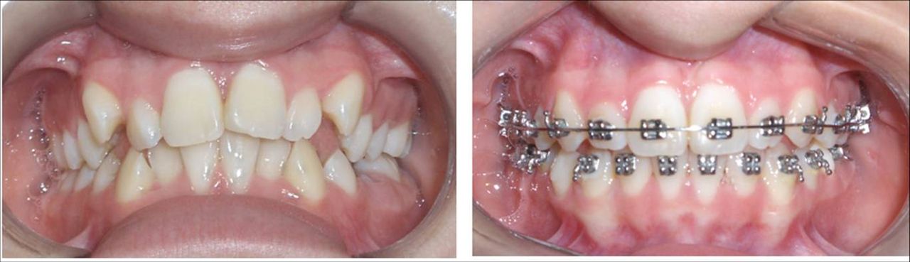 Iris Ocampo Fonseca-11