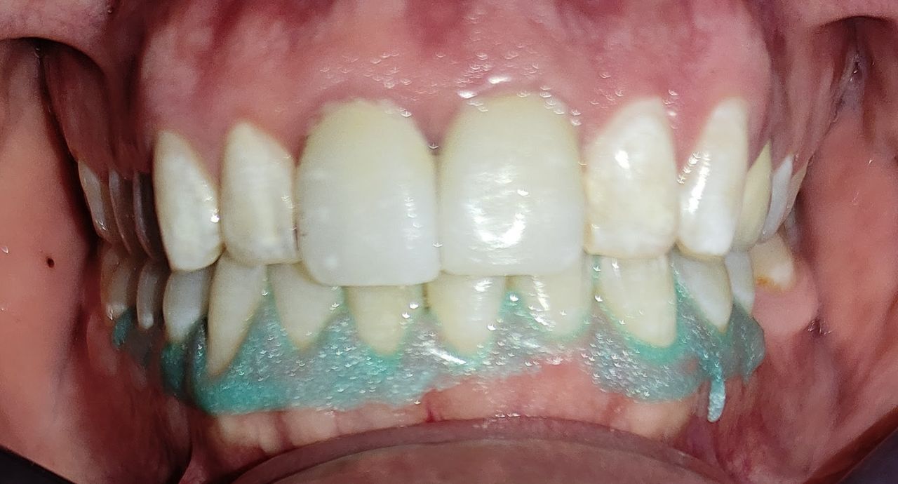 Yaneth Gutiérrez Sánchez-26