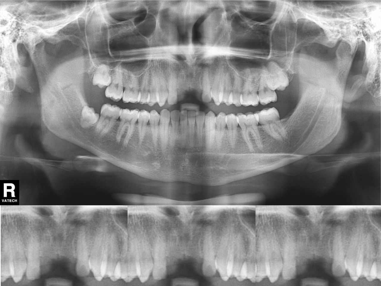 Juan Manuel Méndez Ferrusco-4