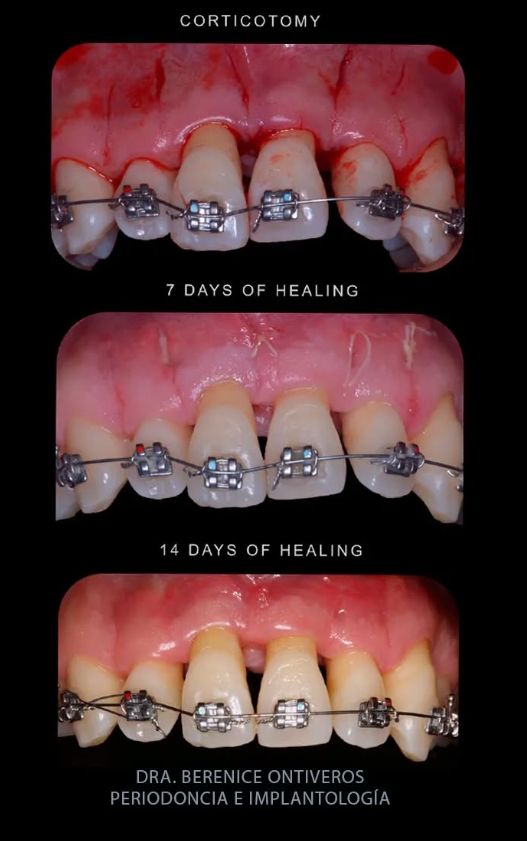 Berenice Ontiveros-5