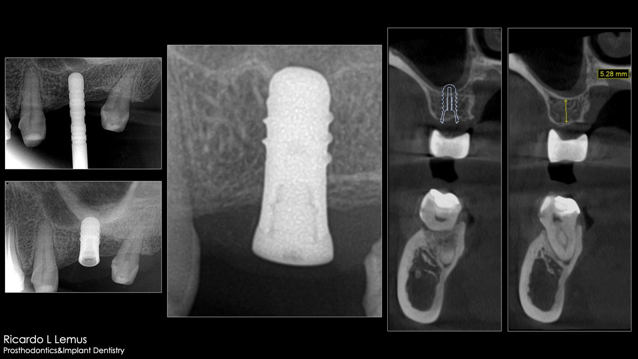 Ricardo López Lemus-21