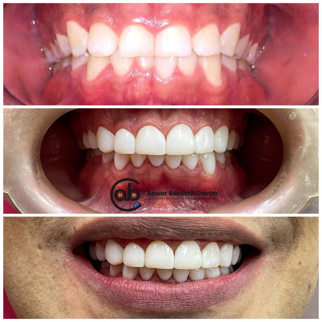 Anuar Becerril Castro-26