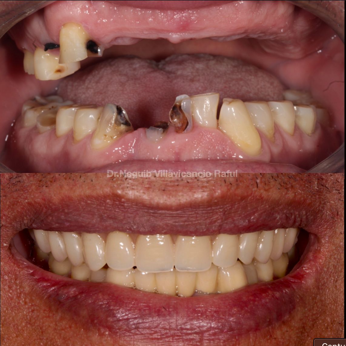 Neguib Villavicencio Raful-56