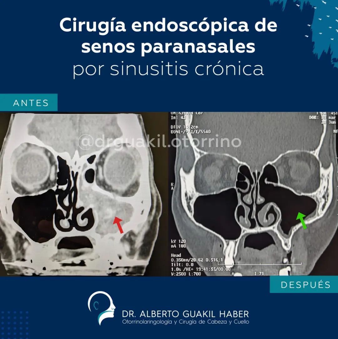 Alberto Guakil Haber-13