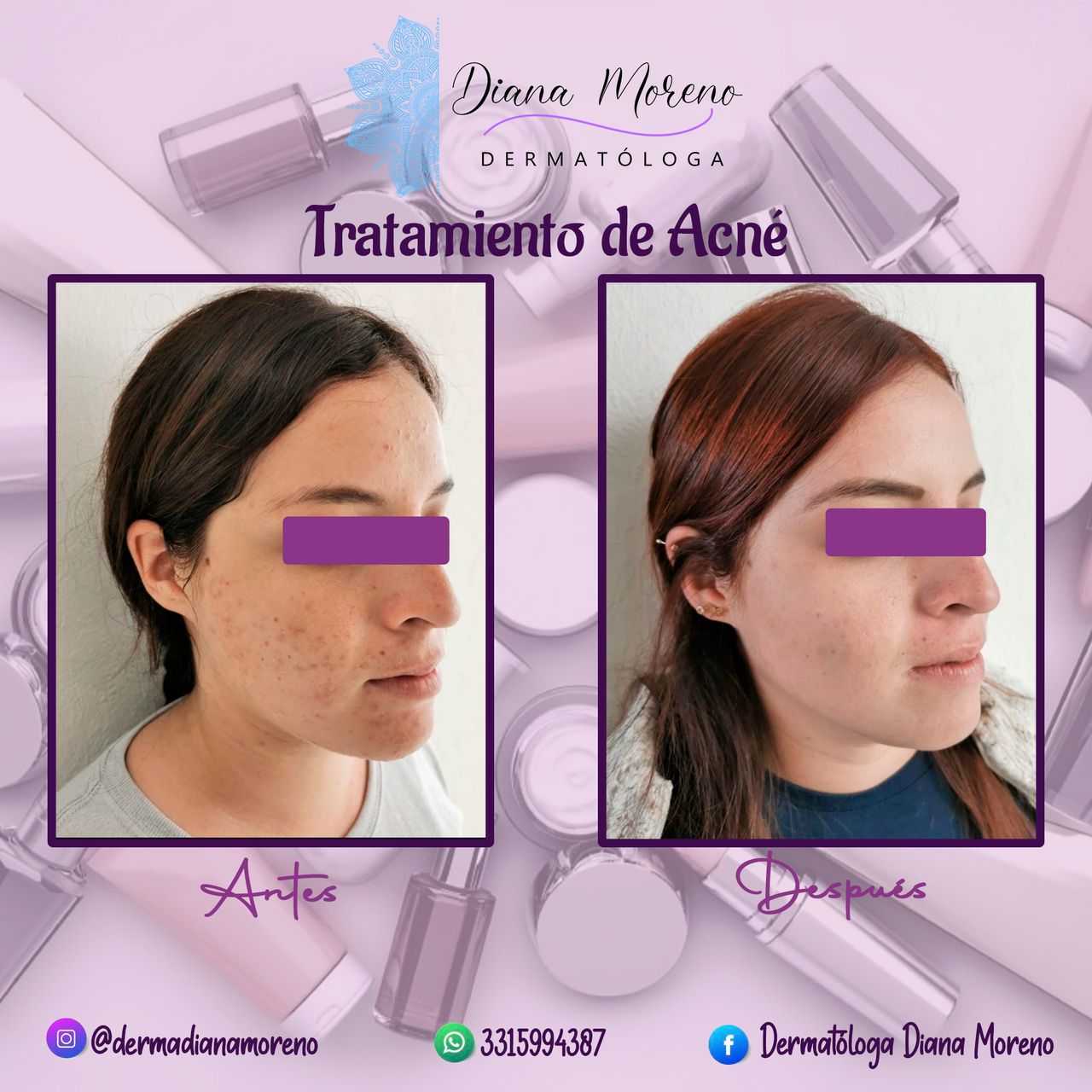 Diana Isis Moreno Nava-4