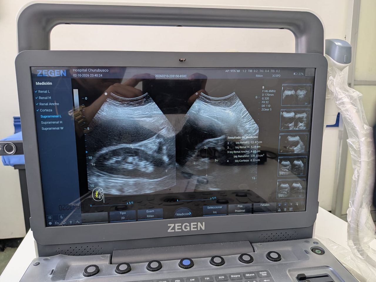 Jorg Augusto Striebel Gonzalez-1