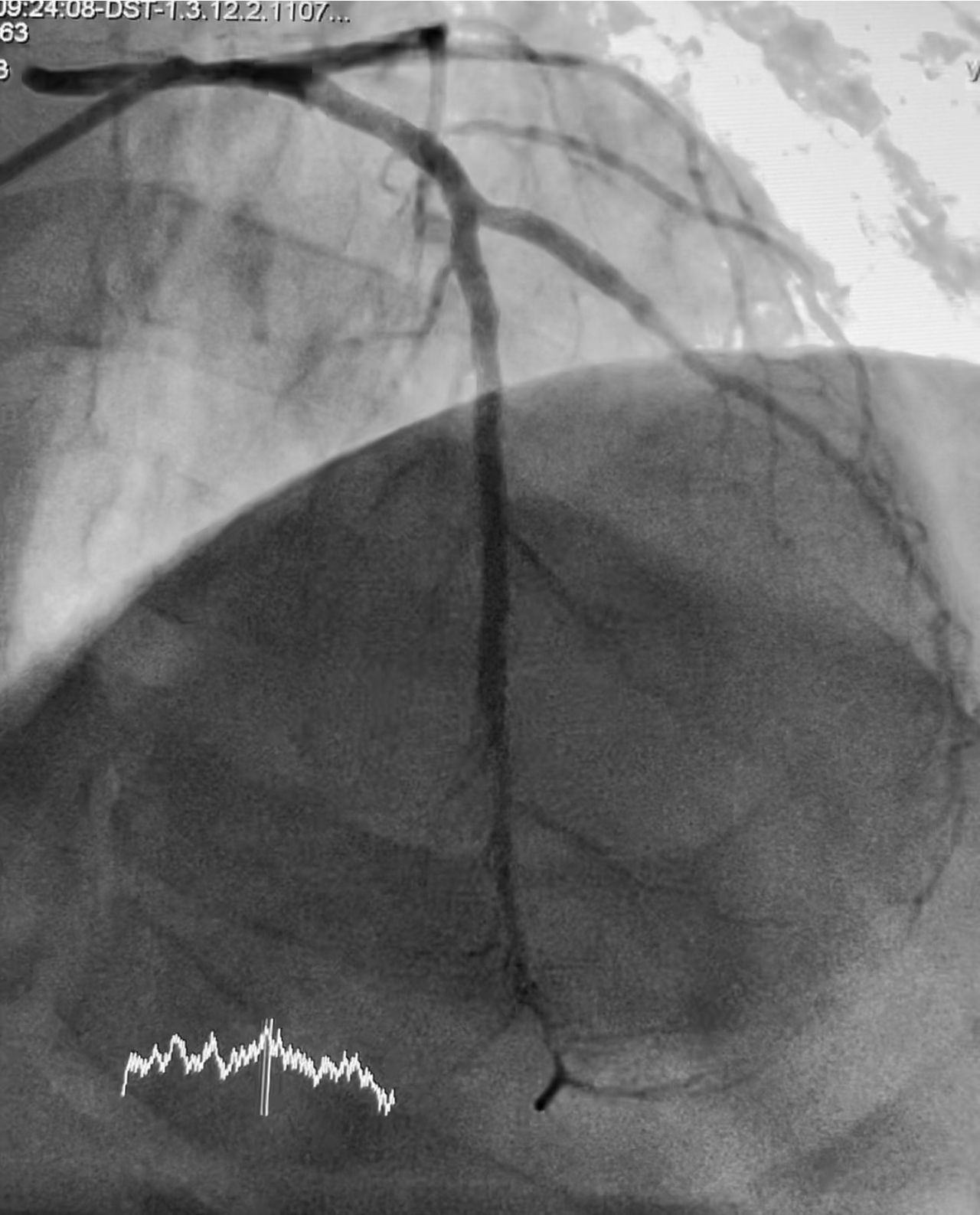 Abdón Ávila Chávez-11