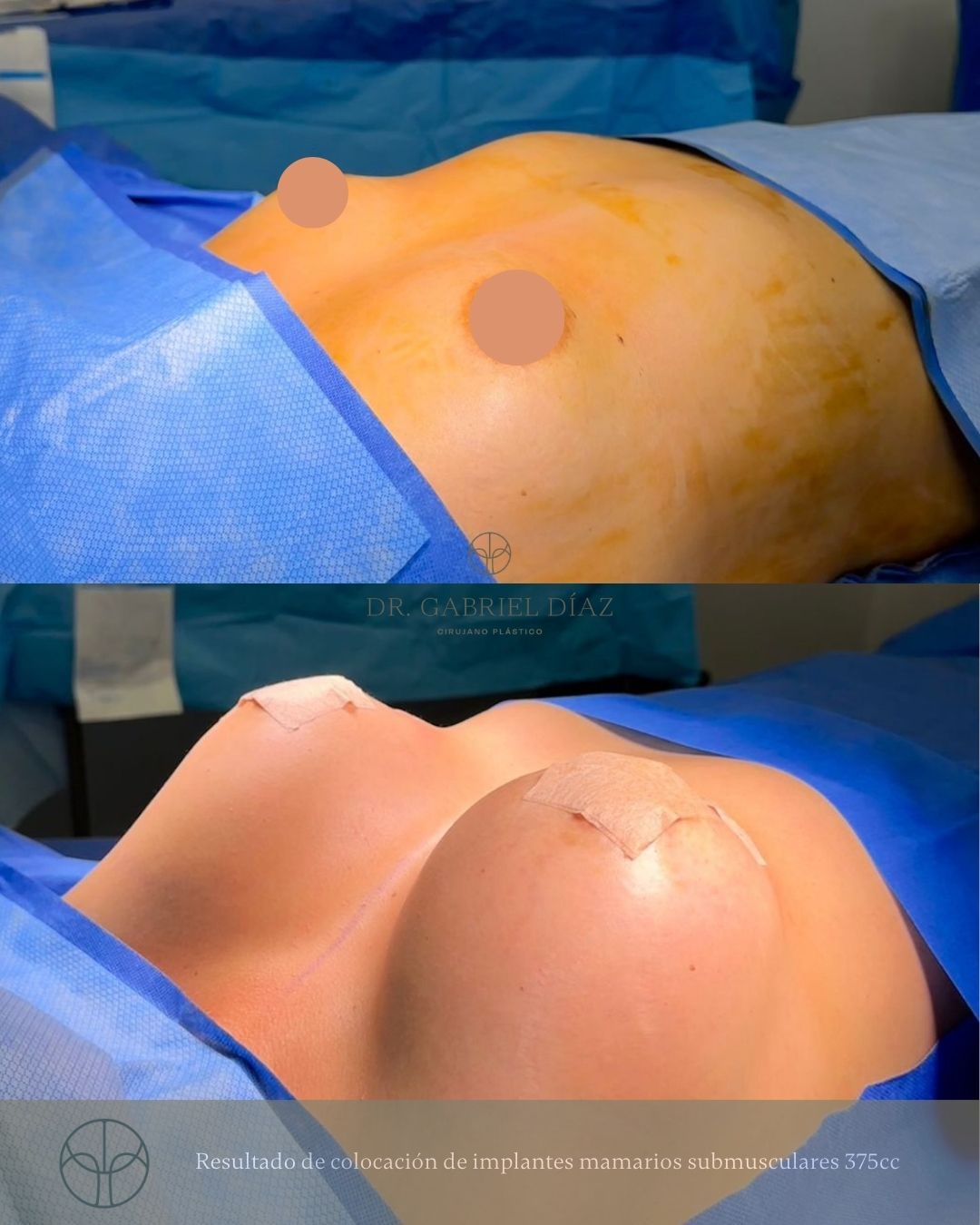 Gabriel Diaz Rosas-8