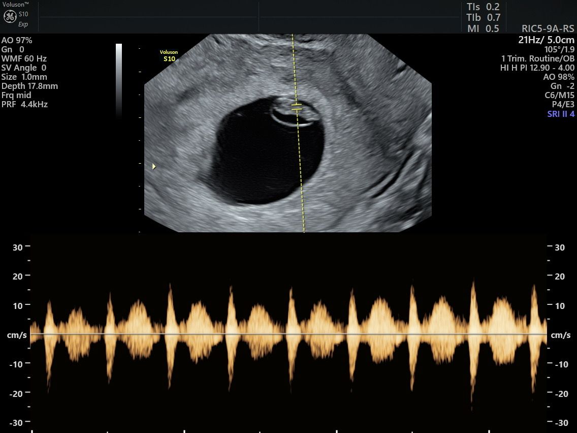Martín Francisco Pérez Peña-1