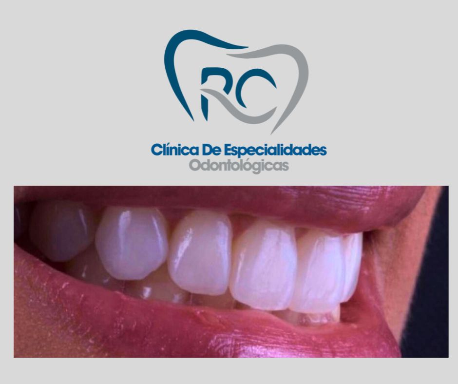 Ernesto Rojas Calderon-15