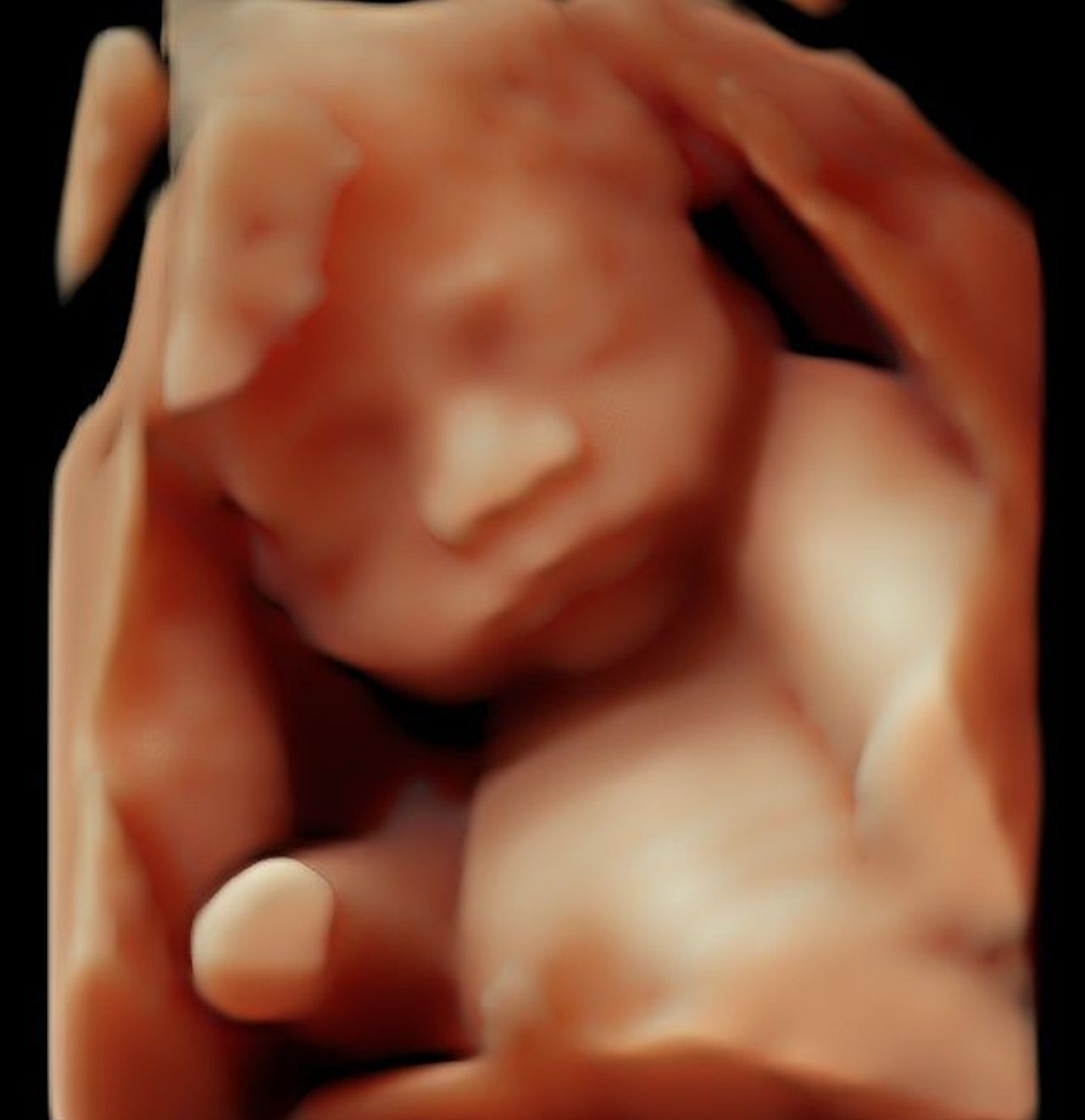 Dulce Anabel Jarquin Arango-51