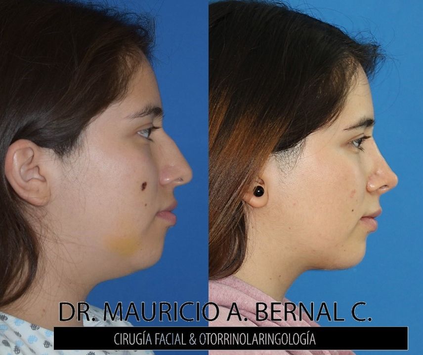 Mauricio Alejandro Bernal Carreon-33