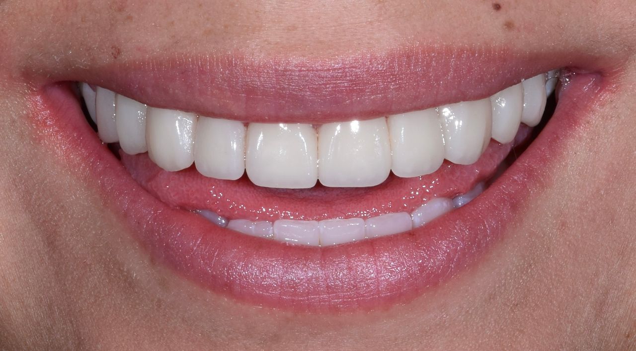 Adair Natanael Alvarez Castañeda-2