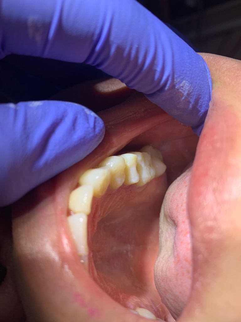 Yuriria Gochy Escalante-7