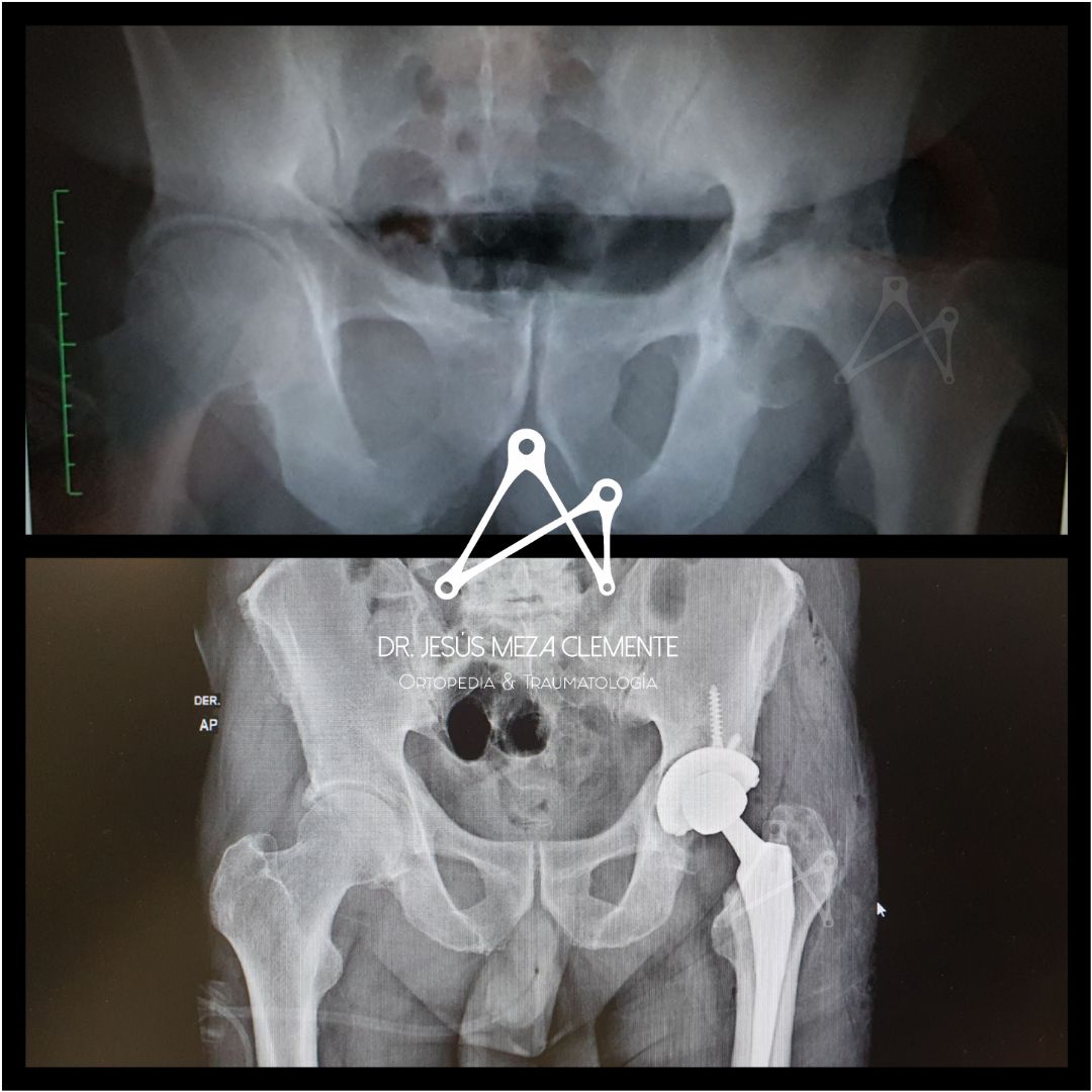 Jesus Octavio Meza Clemente-0