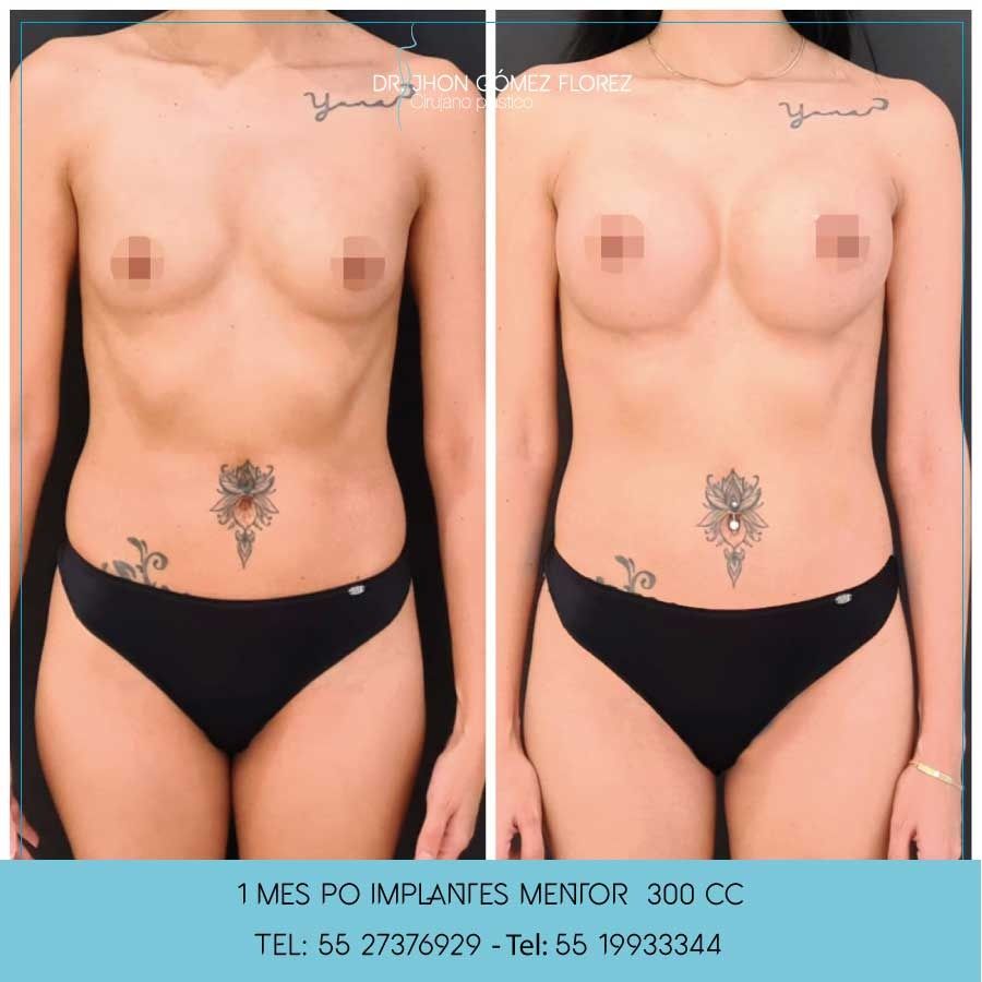 Jhon César Gómez Florez-29