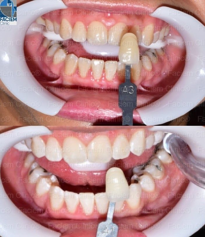 Arlen Colín Ordaz-31