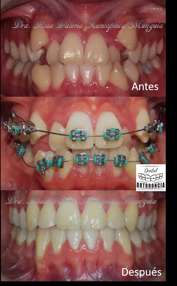 Valeria Xancopinca-6