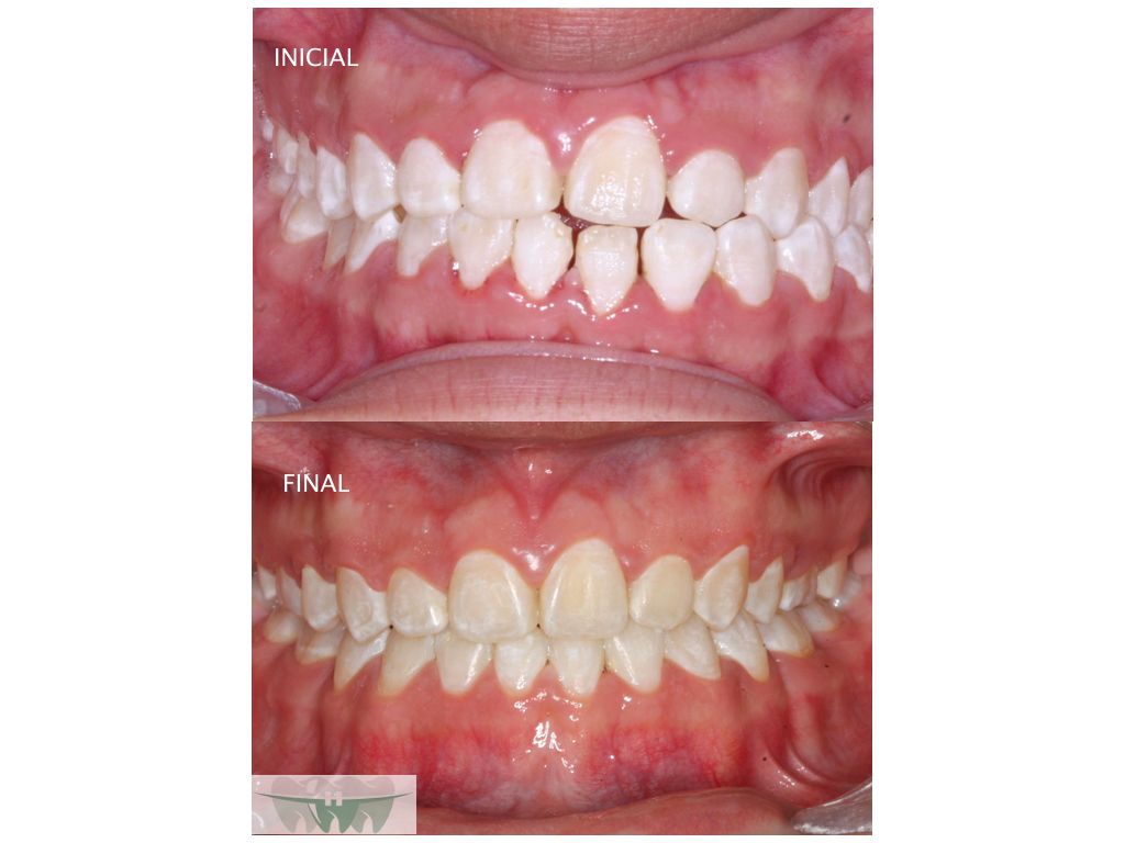 Alerí Morales Rodríguez-6