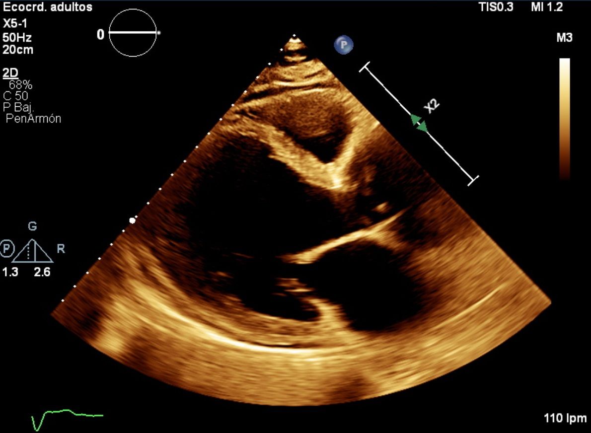 Heriberto Pruneda Ayala-4