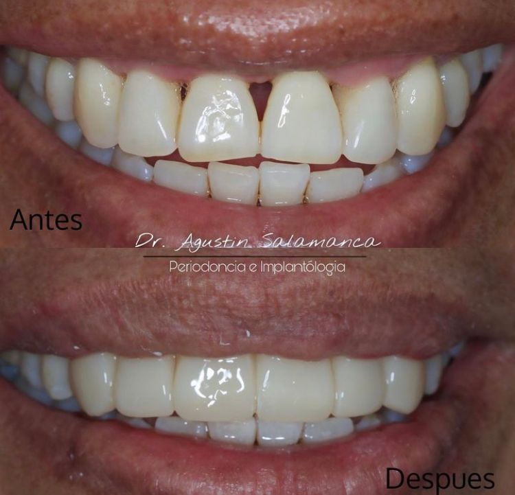 Agustin Salamanca Tapia-19